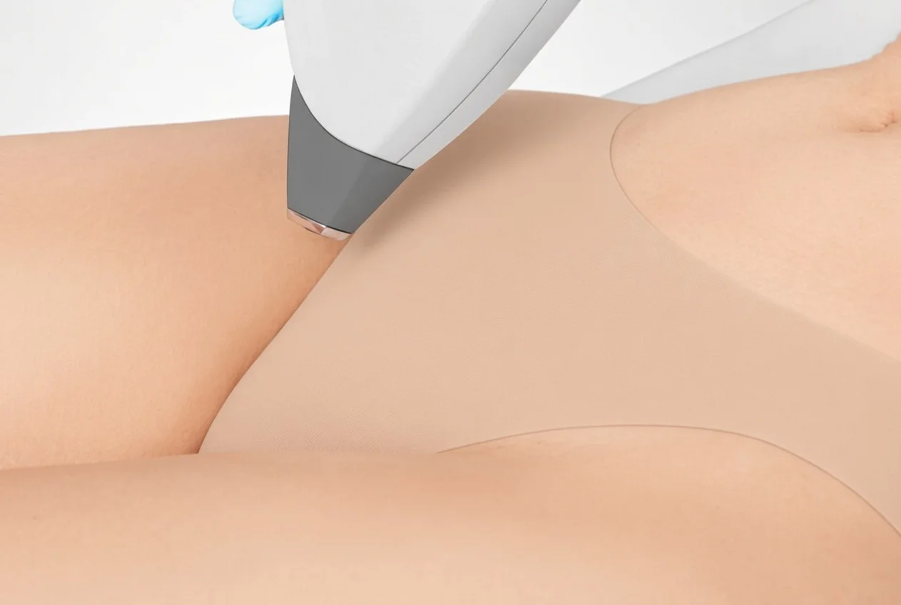 Bikinizone, Diodenlaser-Haarentfernung Wilhelmstraße 88 Lampertheim, KI-Bild